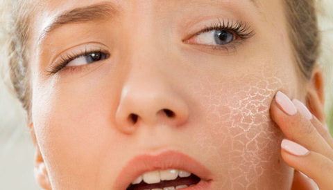 Какой крем выбрать, если шелушится кожа на лице?